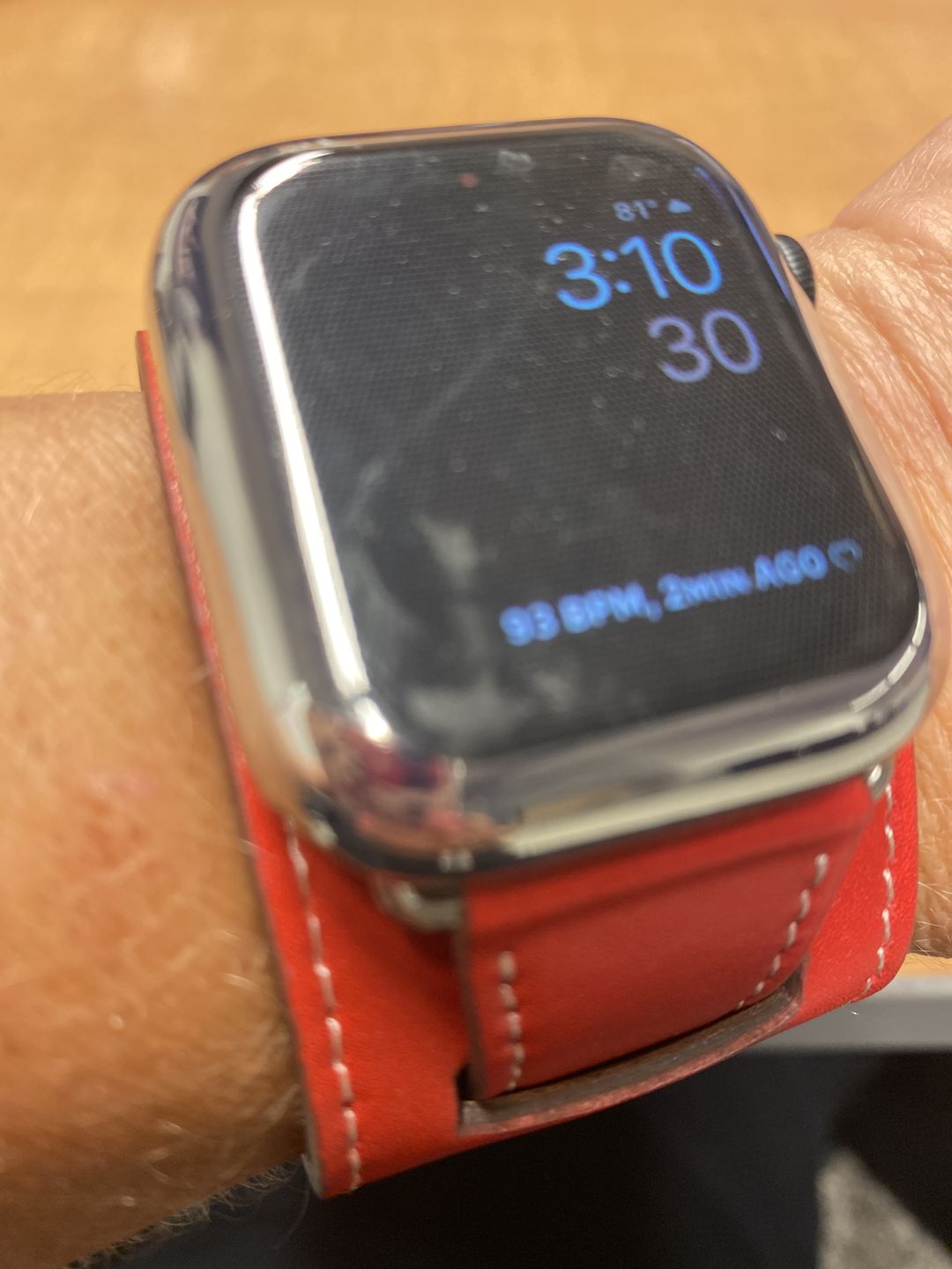 Customer photo review of Dione Leather Band (4 Colours)