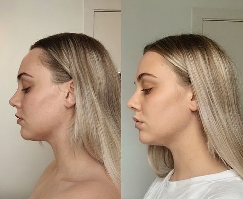 Customer photo review of Rose Guasha Stone