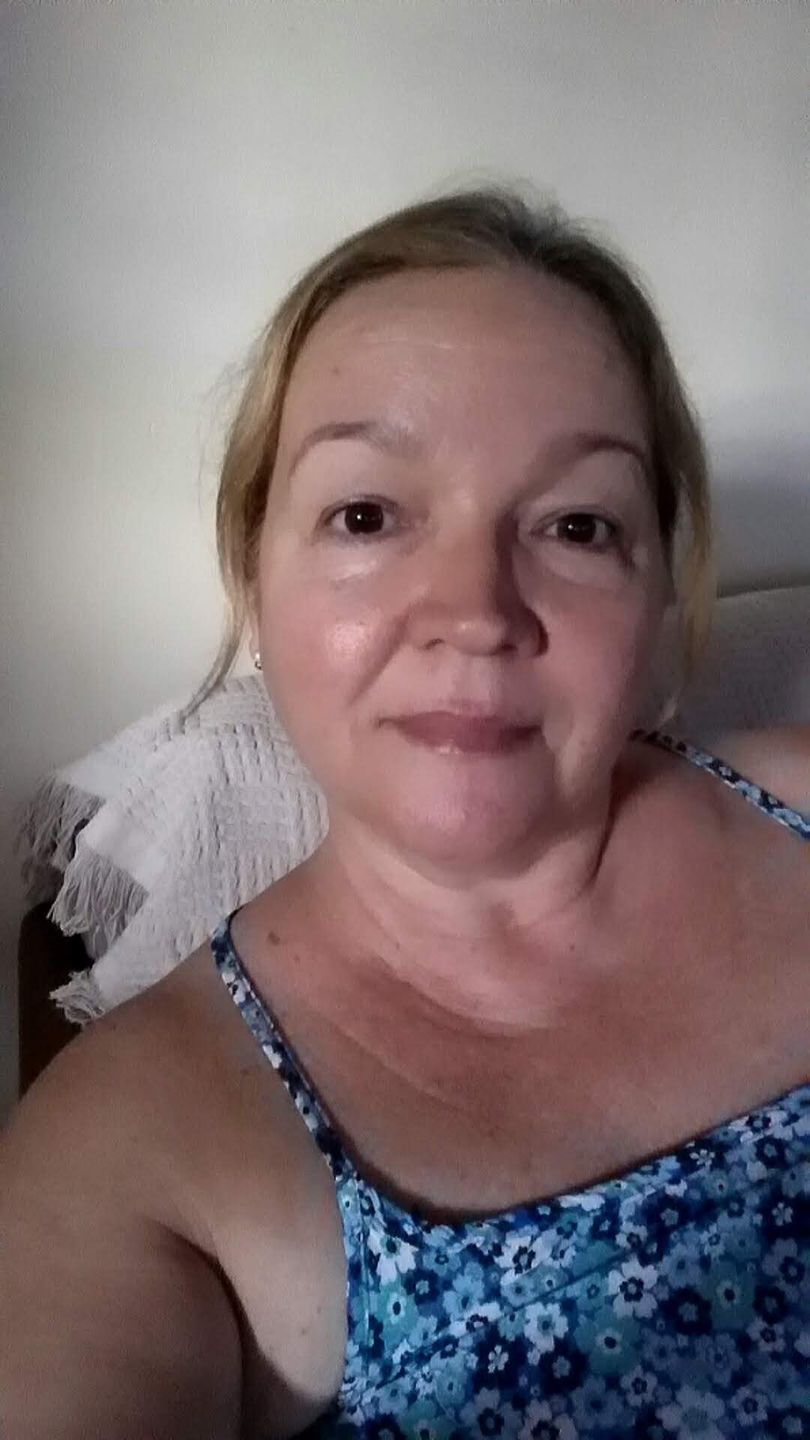 Customer photo review of Óleo de Rosa Mosqueta