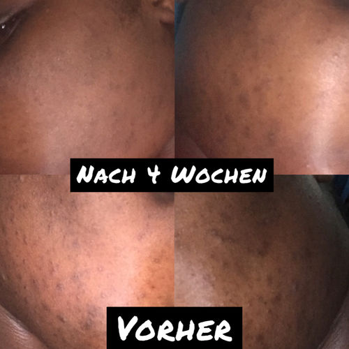 Customer photo review of [W]ASH AWAY - Purifying Gel Cleanser