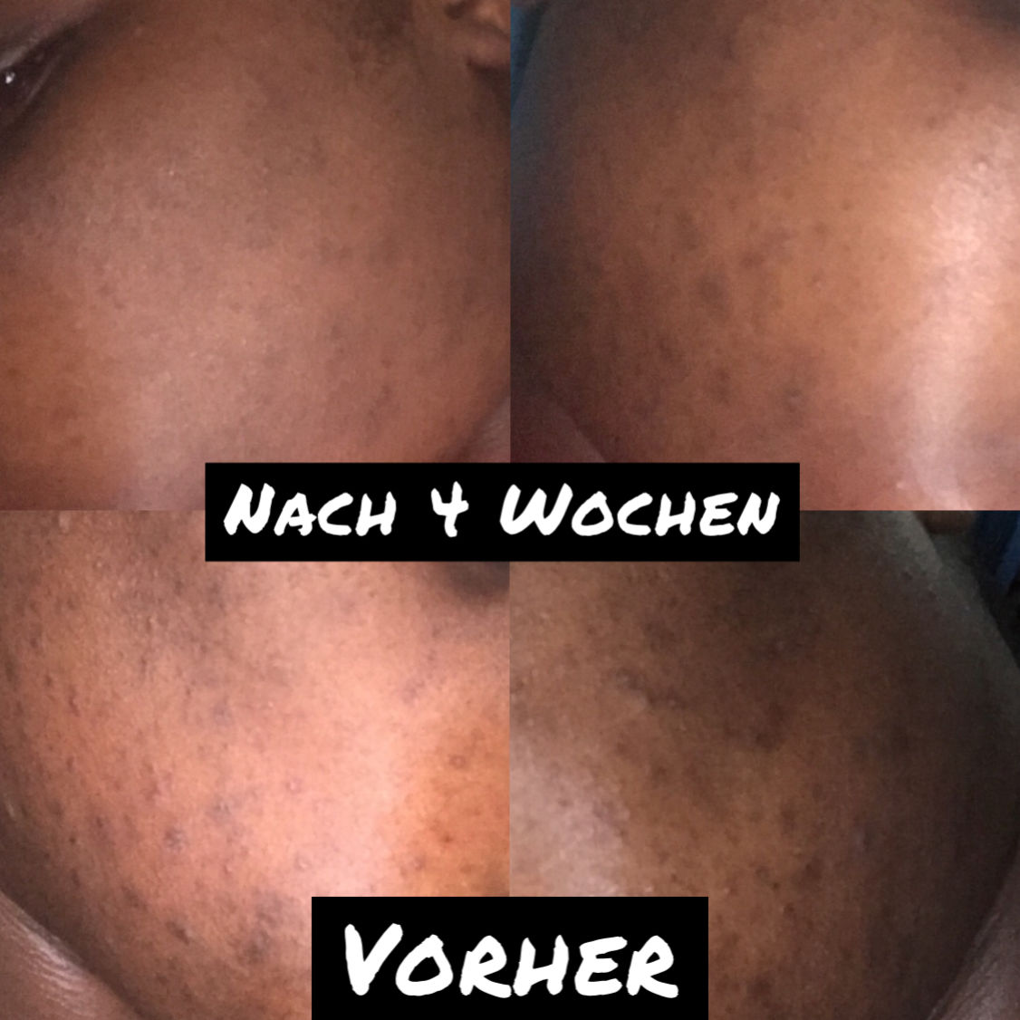 Customer photo review of [W]ASH AWAY - Purifying Gel Cleanser