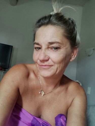 Customer photo review of Sarahbio - huile de pépins de figue de barbarie - 30 mL