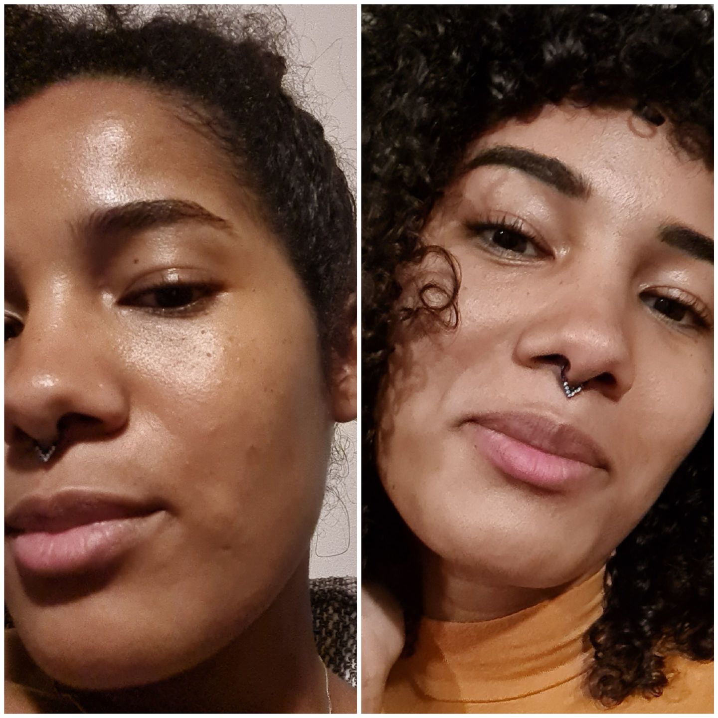 Customer photo review of HYPER G[L]O - Renewing Night Serum