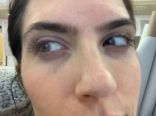 Customer photo review of Eyelash Enhancing Serum