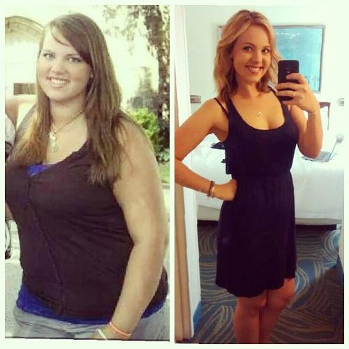 Customer photo review of Herbal Slimming Tummy Patch（Limited Time Discount 🔥 Last Day）