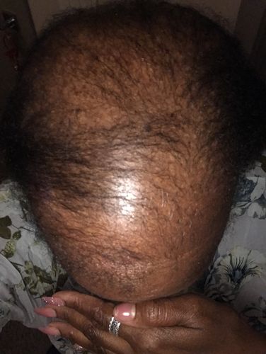 Customer photo review of Styling Bundle