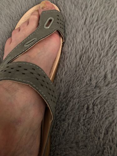 Customer photo review of Sandales Orthopédiques Emmy