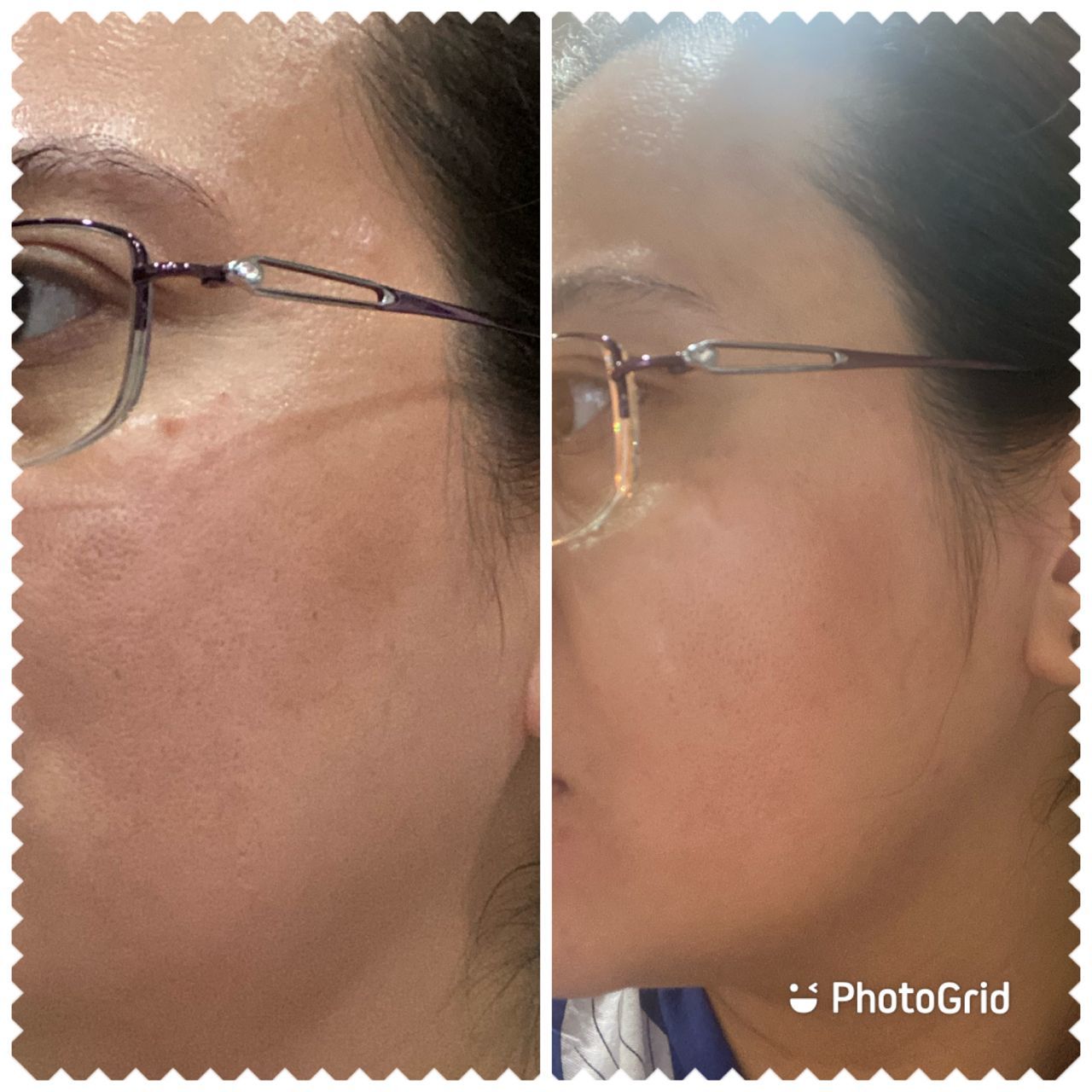 Customer photo review of CLEF RADIANT GOLD ESSENCE (30ml)