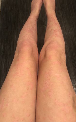 Customer photo review of Multi Strain Biotic
