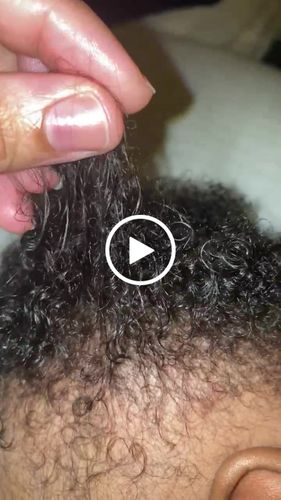 Customer video review of Kid's Super healthy Hair kit