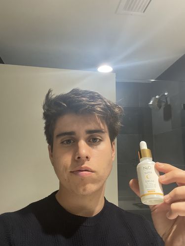 Customer photo review of Super C Serum