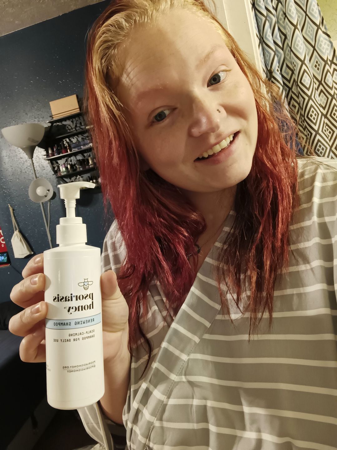 Customer photo review of Psoriasis Honey Scalp Nourishing Kit