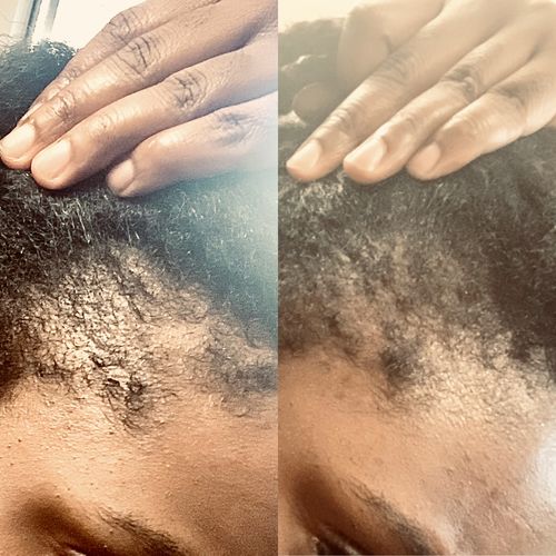 Customer photo review of Hair Growth Potion - Extra Strength 100ml/3.4fl oz