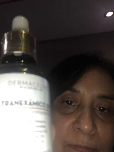 Customer photo review of Sérum Despigmentante Tranexamico 5%