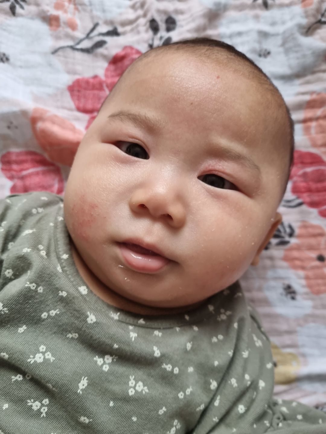 Customer photo review of Eczema Saviour
