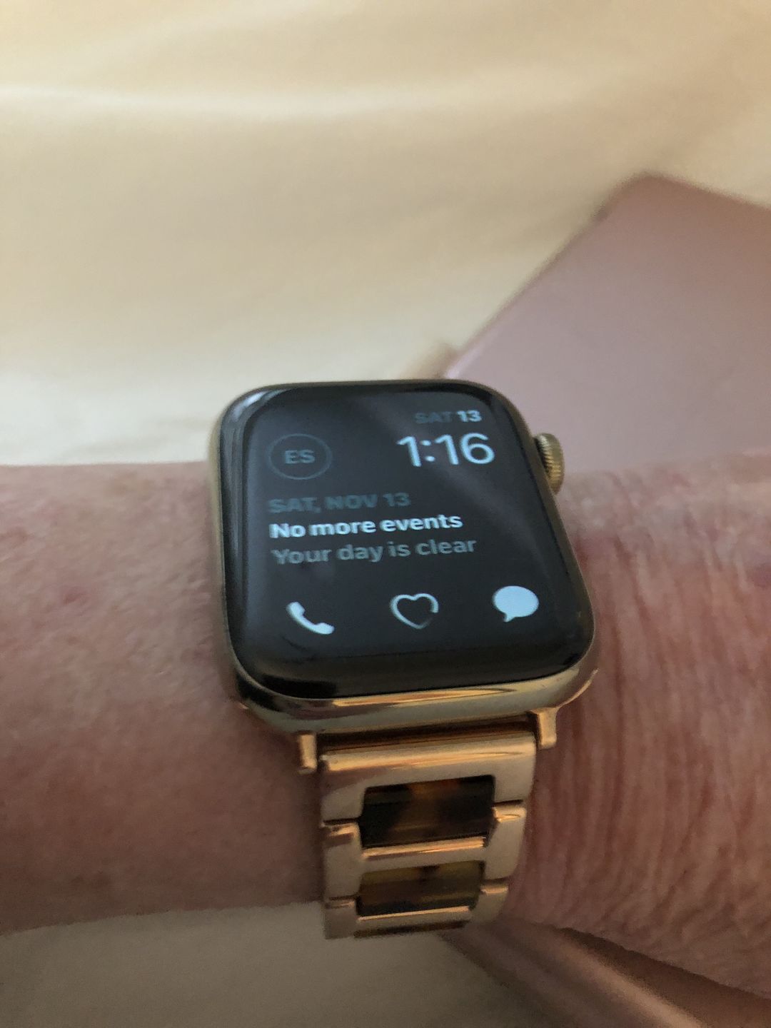 Customer photo review of Aura Metal Band (11 Colours)