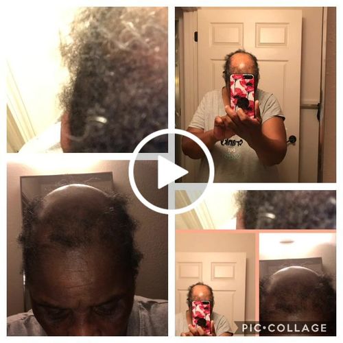 Customer video review of Organic Hair Growth Oil