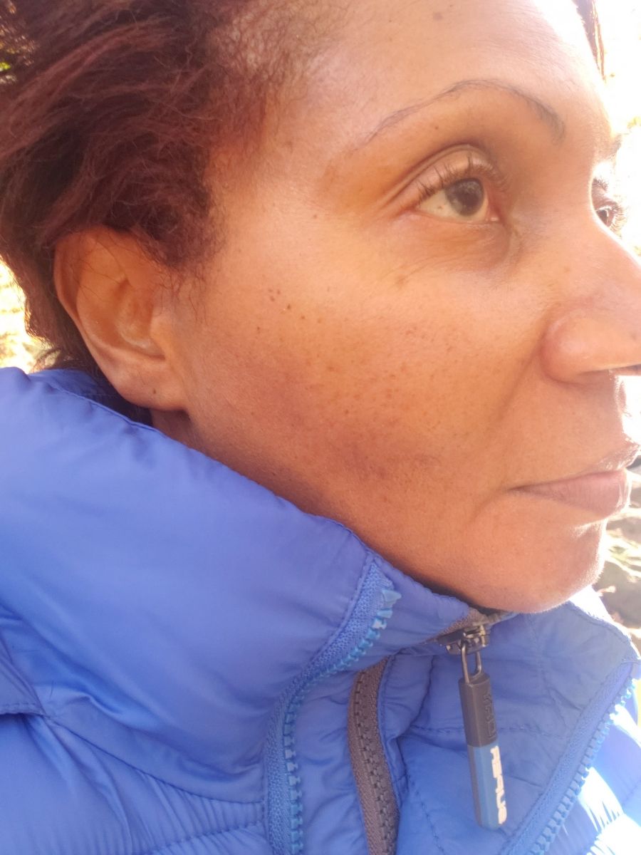 Customer photo review of HYDRATING MOISTURIZER
