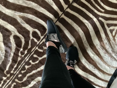 Customer photo review of Astra Sneakers - Instant Foot Pain Relief