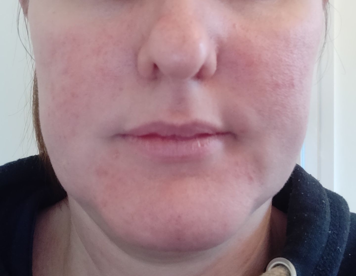 Customer photo review of Healing Miracle Cream