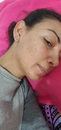 Customer photo review of Serum Niacinamida