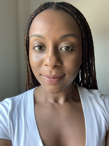 Customer photo review of SEOUL FOOD SERUM FOR DARK SPOTS & TEXTURE