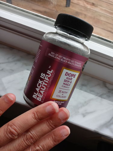 Customer photo review of Black Is Beautiful- Advanced Hair Skin & Nails Gummy (45 Day Supply/ .64 Cent A Day) CLICK HERE