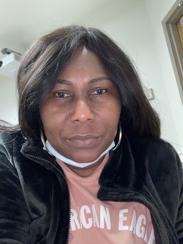 Customer photo review of POWERFUL® Anti-Aging Skin BleachBar