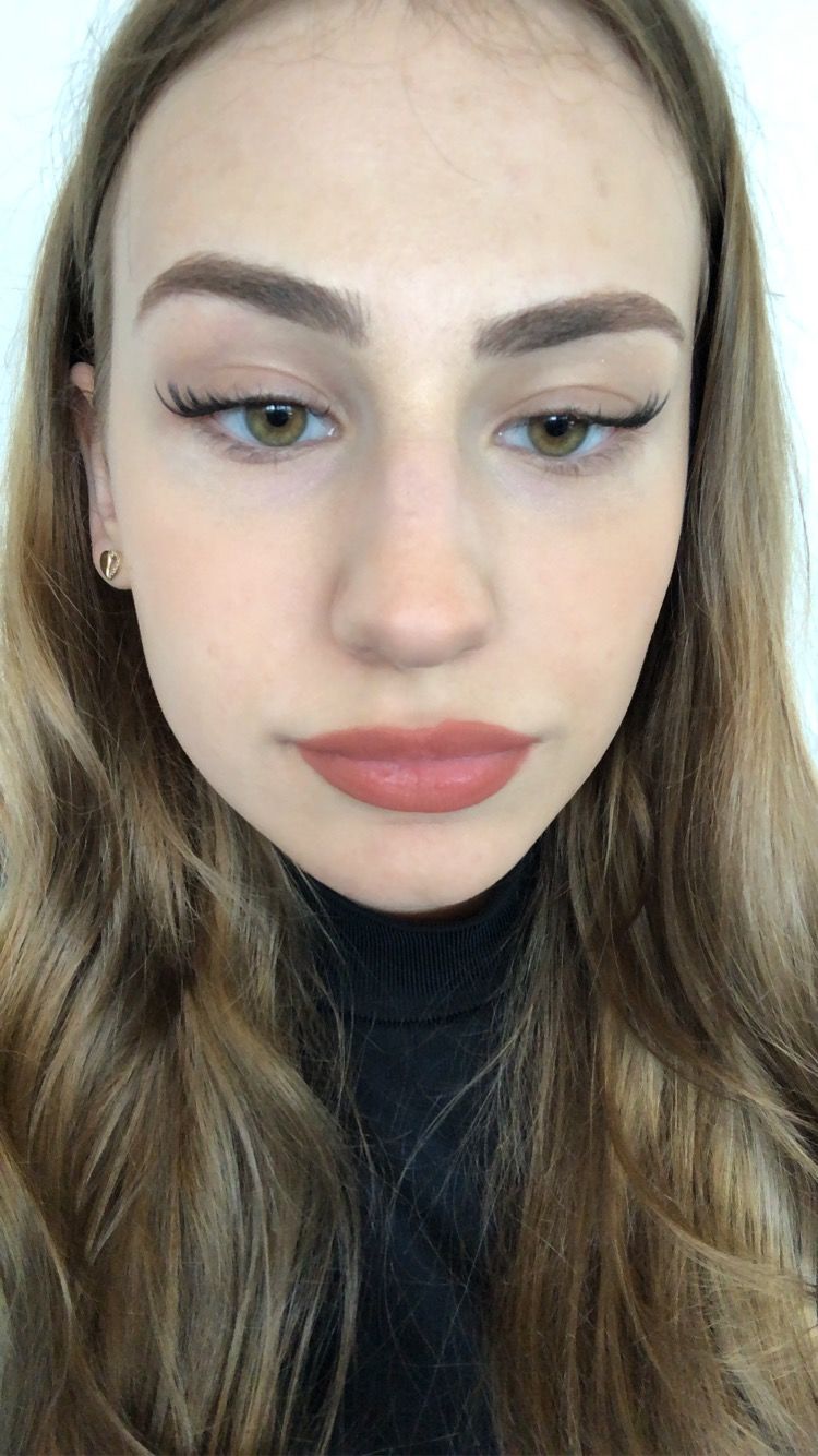 Customer photo review of HYPER G[L]O - Renewing Night Serum