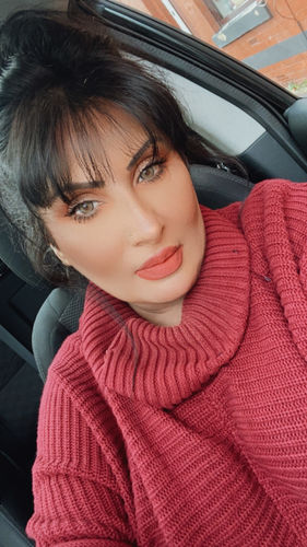 Customer photo review of Neala Green Contact Lenses(12 months wear)
