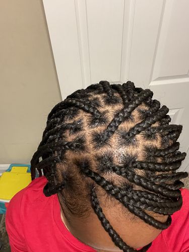Customer photo review of Growth Complex Hair Growth Scalp Stimulator