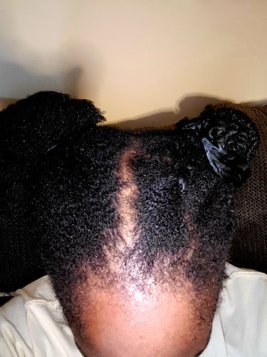 Wanda R. review of Fro Butter With Black Seed Oil | For Dry Skin & Dry Hair image 1 out of 1