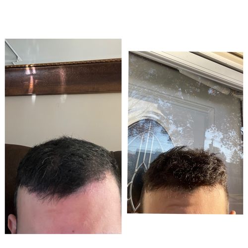 Customer photo review of India’s Secret Ancient Ayurvedic Hair Follicle Elixir (3 sizes)