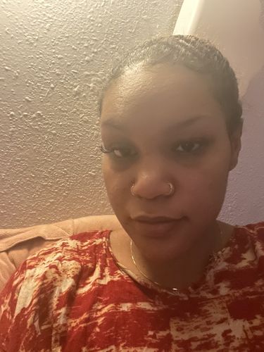 Customer photo review of SEOUL FOOD SERUM FOR DARK SPOTS & TEXTURE