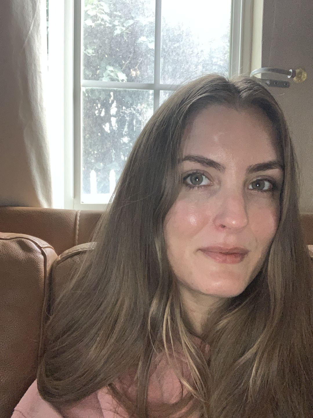 Customer photo review of Super Seed Oil Facial Serum (SSO) 15.00% Off Auto renew (Ships every 60 Days)