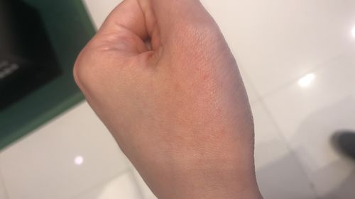 Customer photo review of Coco 清爽保濕套裝 (濕疹修護霜+蘆薈舒緩保濕凝膠)