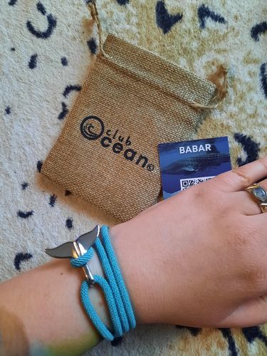 Customer photo review of "Whale" tracking bracelet