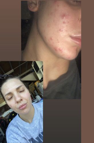Customer photo review of 20-Day Inside & Out™ Gut Program