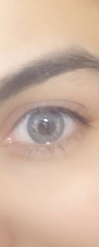 Customer photo review of Hanthy Gray Contact Lenses(12 months wear)