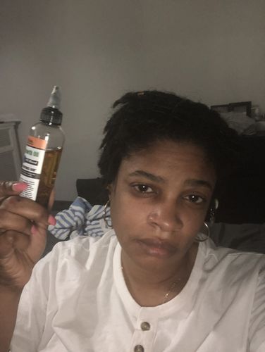Customer photo review of Herbal Hair Growth Oil