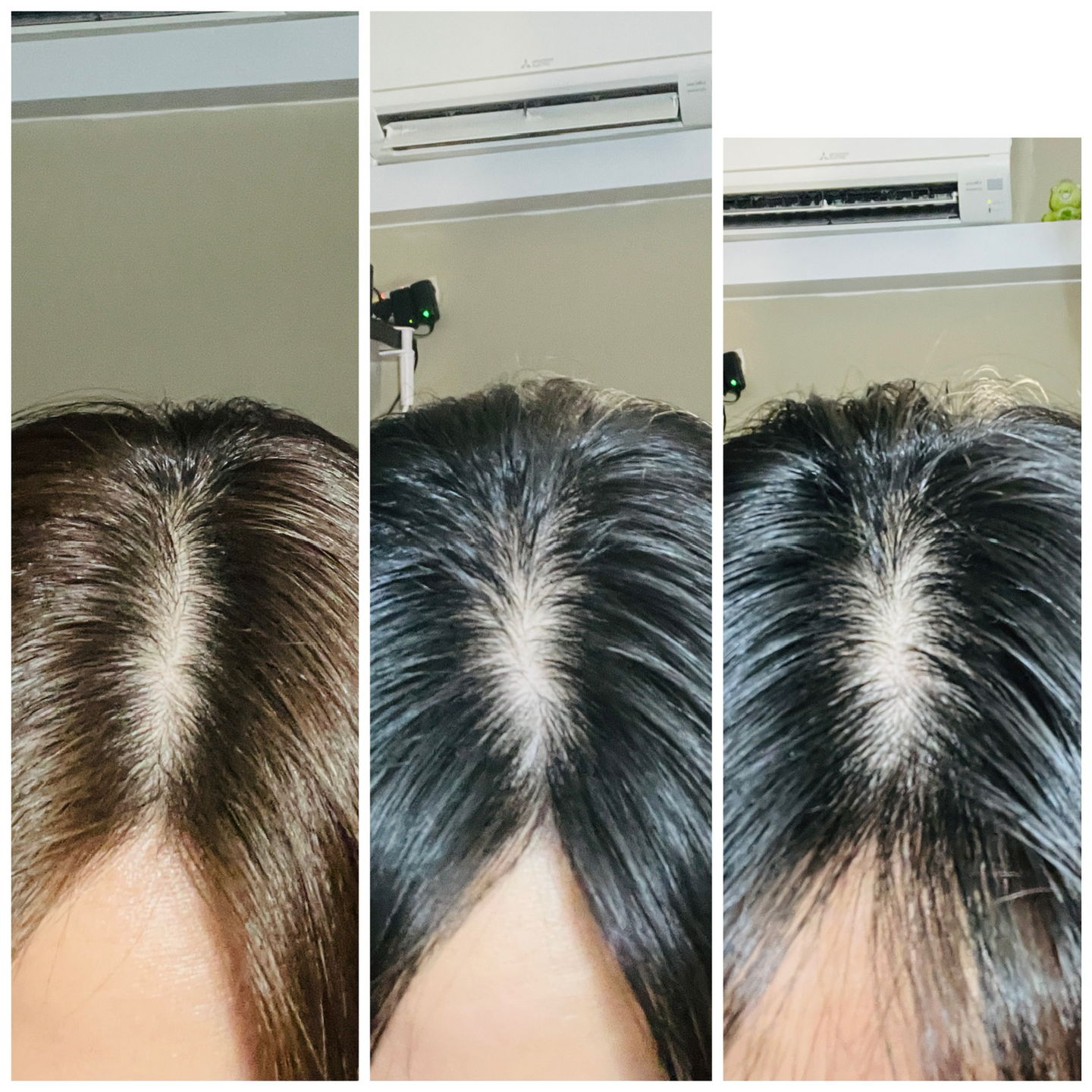 Customer photo review of [ SMIB ] -Buy 1 Free 1 - Discovery Kit 100ml Set Bundle Deal