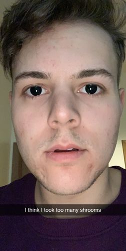 Customer photo review of MOJOSEE Pure Black Colored Contact Lenses