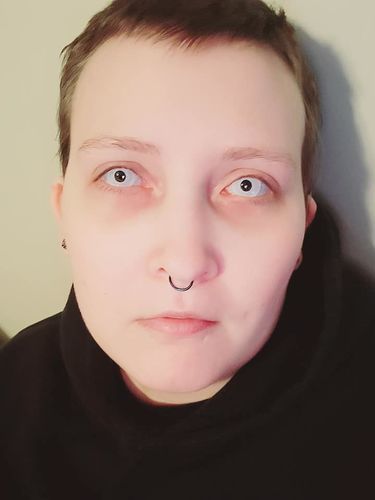 Customer photo review of MOJOSEE Pure White Ring Colored Contact Lenses