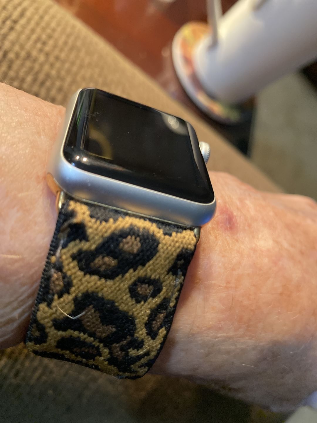 Customer photo review of Straton Stretchy Nylon Band (8 Colours)