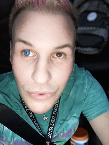 Customer photo review of Polar Lights Blue Prescription Colored Contact Lenses