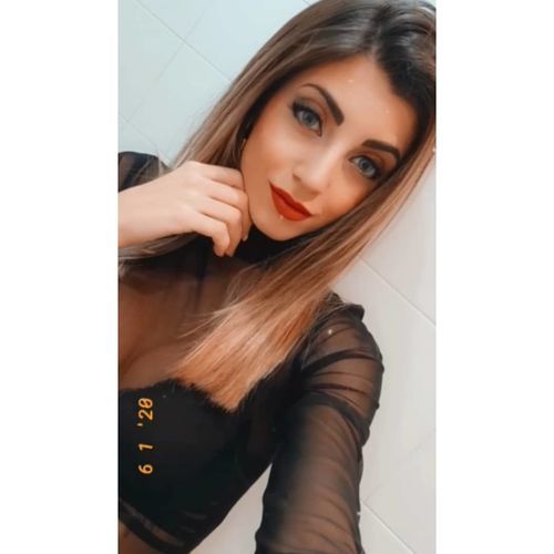 Customer photo review of MOJOSEE Aurora Blue Colored Contact Lenses