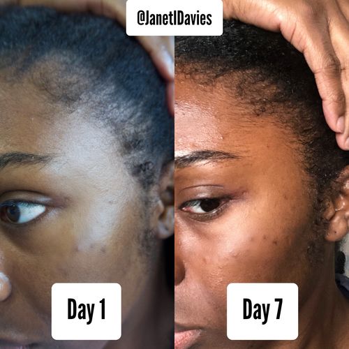 Customer photo review of Hair Growth Potion - Extra Strength 100ml/3.4fl oz