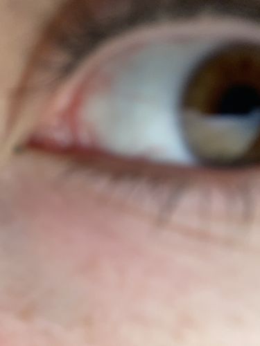 Customer photo review of SL29 Green Contact Lenses(12 months wear)