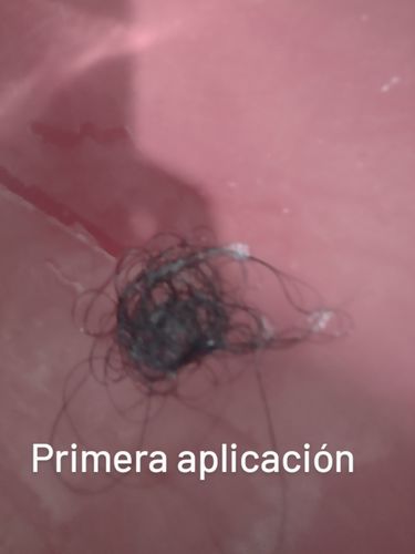 Customer photo review of Shampoo Anticaida , Barra