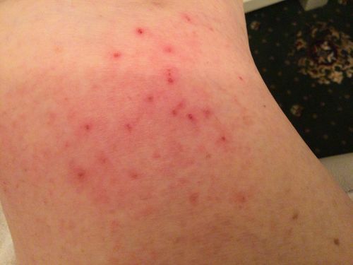 Customer photo review of Multi Strain Biotic